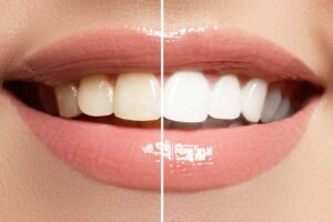 Teeth and Gum Health Supplement